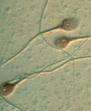 Nuevo Test detecta Espermatozoides Anomalos