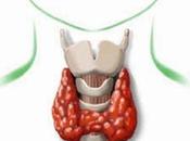 Remedios nutricionales contra tiroides