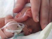 bebés prematuros pueden desarrollar hipertensión
