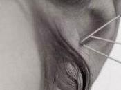 Tinnitus, Acupuntura Otros Tratamientos Utilizados