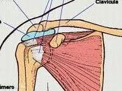 Causas, diagnostico tratamiento Tendinitis
