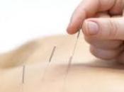 acupuntura podría aliviar síntomas EPOC