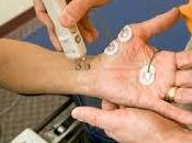 ¿Qué Electromiografía?