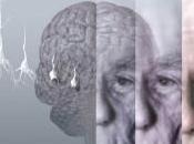 Fracasa prueba droga para Alzheimer