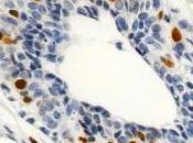 Investigan sobre rejuvenecimiento células madre hematopoyéticas