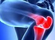 pueden prevenir dolores articulares rodilla?