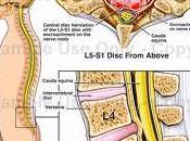 Gran parte lesiones región pueden evitadas ejercicios adecuados posturas correctas