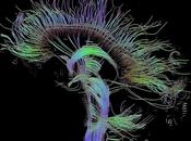 Neuroimagen (III): Resonancia magnética, funcional Conectoma