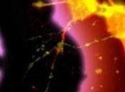cesárea afecta cerebro bebé