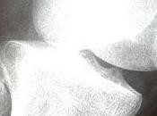 cuidado salud ósea fundamental para prevenir osteoporosis