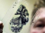 Científicos descubren principios crean conexiones entre neuronas