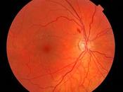 Detectar alzheimer ojos