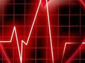 estrés laboral aumenta riesgo sufrir infarto miocardio