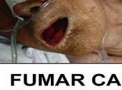 Guerra tabaco