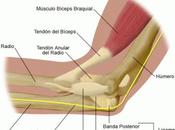 Tratamiento inyecciones para codo tenista