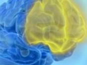 Neuromarketing
