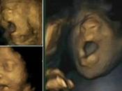 bebés bostezan dentro vientre materno