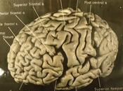 estudio afirma cerebro Einstein distinto