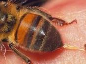 ¿Cómo sacar aguijón picadura abeja avispa?