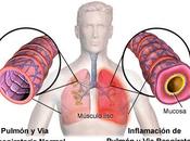 Como presenta bronquitis nuestro organismo