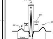 Apple patenta monitor cardíaco integrado iPhone