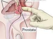 Prostatitis