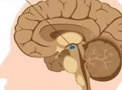 sistema nervioso afectado enfermedad Parkinson