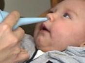 Cómo utilizar pera goma para limpiar mucosidades bebé