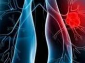 Registran Cuba vacuna Racotumomab para cáncer pulmón