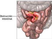 oclusión intestinal aguda como enfermedad intervención rápida