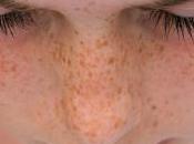 pecas