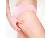 Tratamientos Para Celulitis