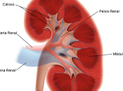 Absceso renal, síntomas produce cuál diagnóstico