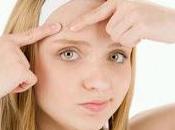 Isotretinoina (roacutan) dosis baja, ¡funciona!