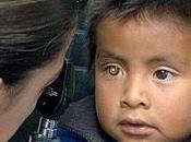 Cuidando ojos niños, primera parte