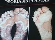 Psoriasis, amenazas piel comunes México