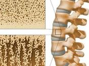 Alimentos ayudan prevenir osteoporosis