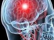 Cómo identificar sintomas accidente cerebro vascular