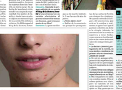 Marzo