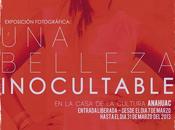 Exposición Fotográfica: belleza inocultable