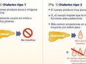 Todo cerca diabetes tipo2