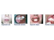 Terapia miofuncional ortodoncia