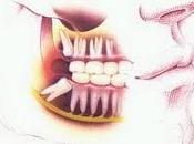 ☻Como prevenir dientes retenidos.