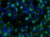 Retina artificial creada células madre