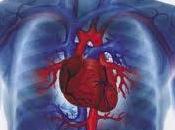 Cuáles síntomas signos insuficiencia cardíaca, mecanismos compensación