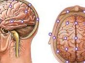 electroencefalograma, como funciona cuando someterse