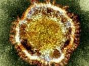 NUEVO CORONAVIRUS nCoV DEJA VARIOS MUERTOS ARABIA SAUDITA