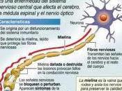 Disfrutar sexo pesar esclerosis múltiple
