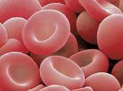 Consejos para combatir anemia