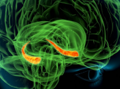 recuerdes puede erroneo